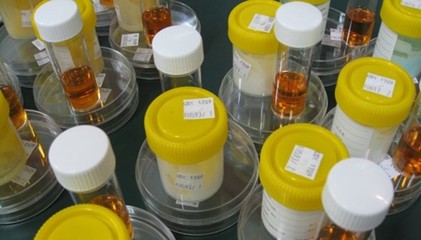 化妝品FDA測試抗菌效果-防腐劑(USP 51)測試